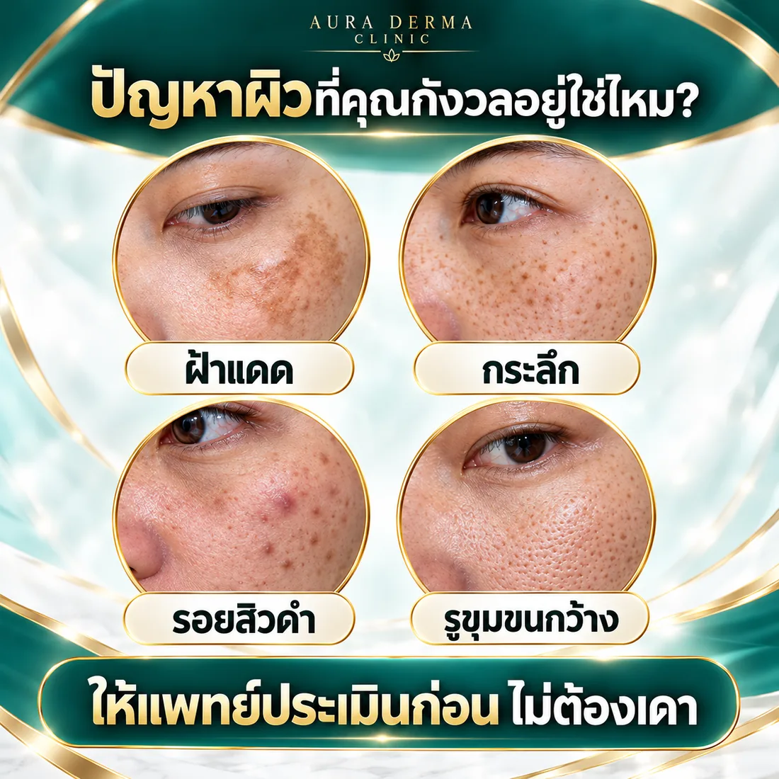 ฝ้าแดด กระลึก รอยสิวดำ รูขุมขนกว้าง